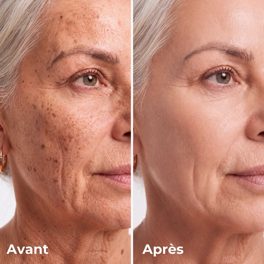 4. Estompe les taches et les anciennes cicatrices