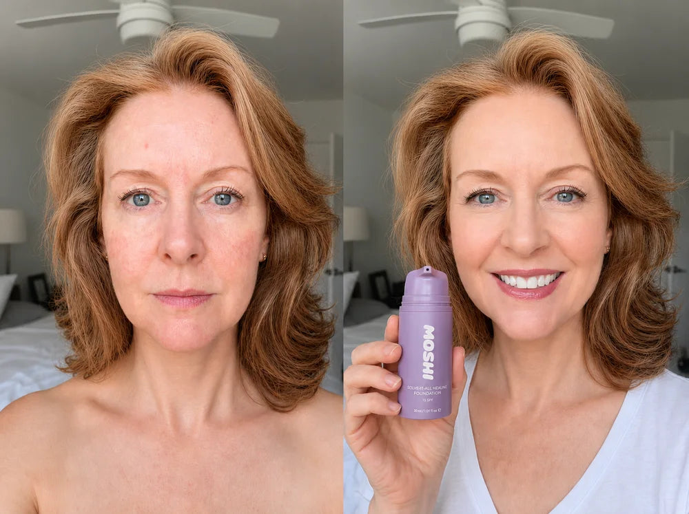 Carol N., avant et après