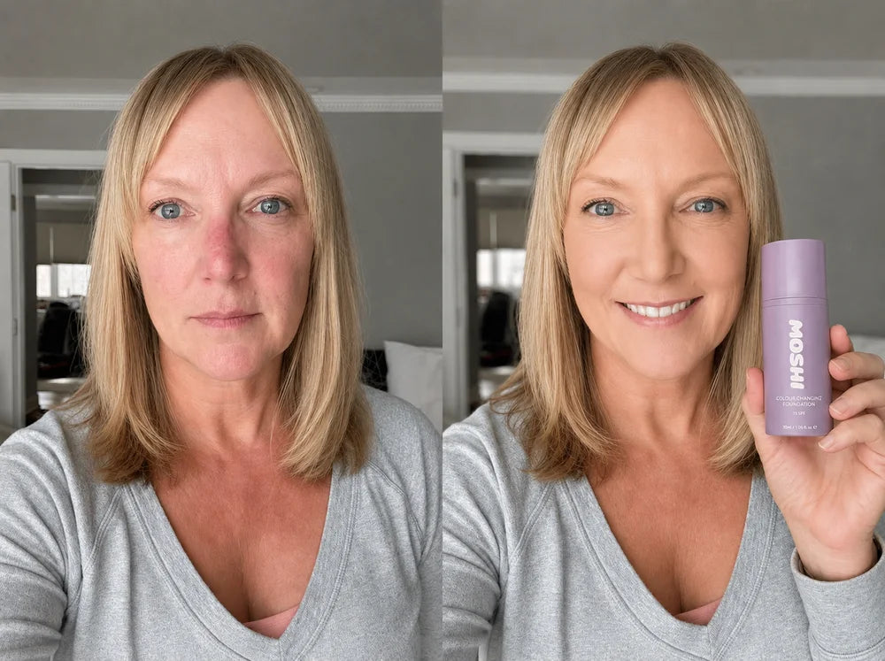 Karen B., avant et après